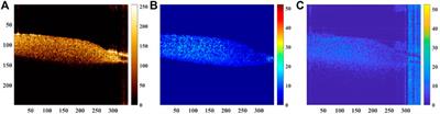 High-resolution characterization of the coagulation and drying processes of whole blood based on optical coherence tomography